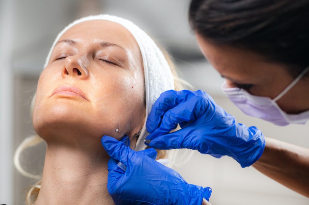Mesotherapy Facelifting Procedure. 3D Meso Threads.