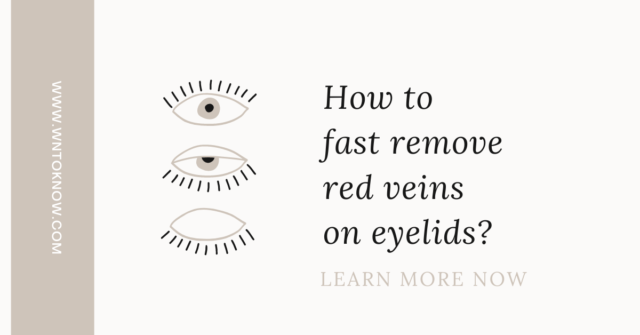 red veins on eyelids