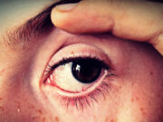 Why does Your Eyes Hurt When You Blink? How Bad is it? eyes hurt when you blink