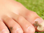 How to cure Toenail Fungus in 7 days toenail fungus cure